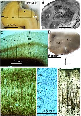 The large numbers of minicolumns in the primary visual cortex of humans, chimpanzees and gorillas are related to high visual acuity